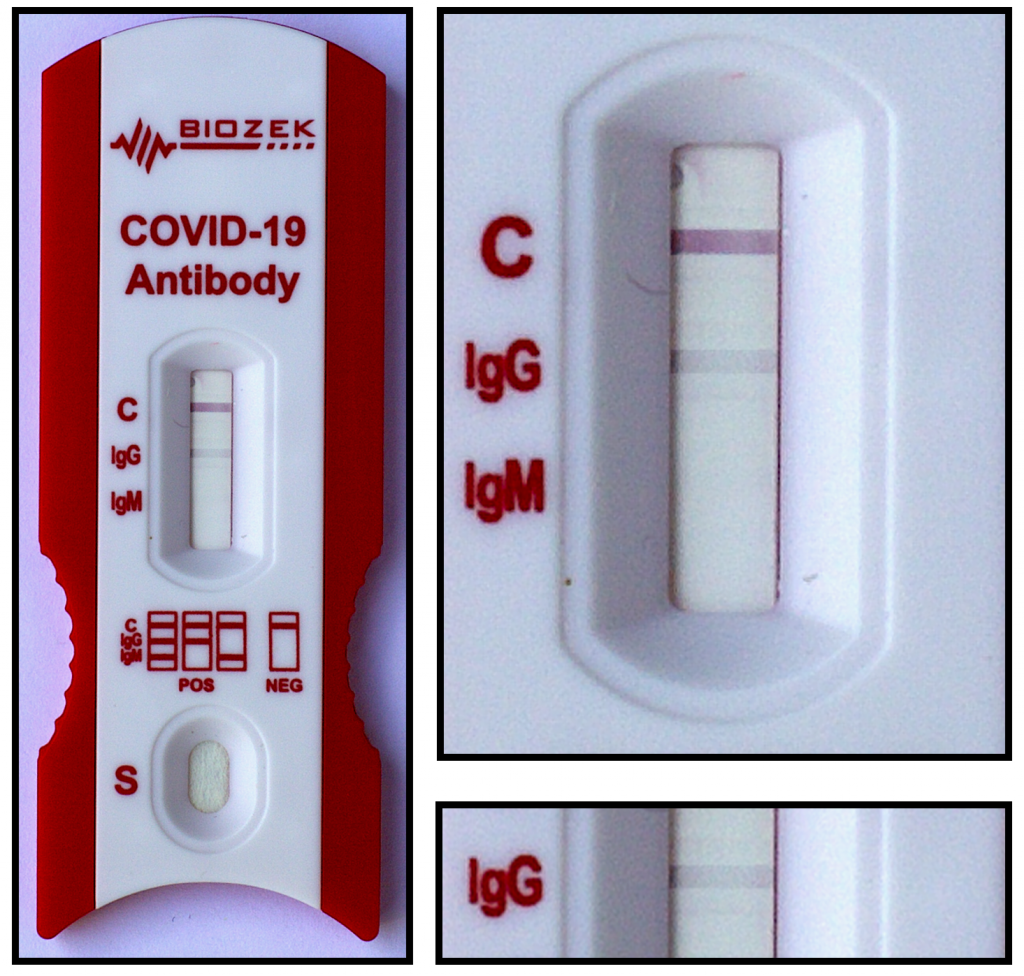 тест на коронавирус COVID-19